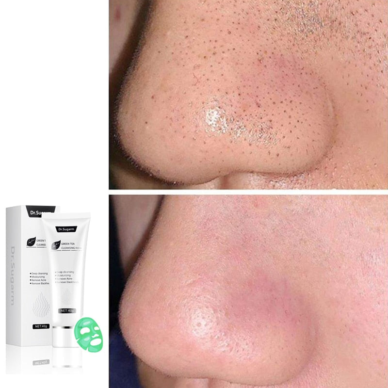 Green Tea Blackhead Peel-Off Mask